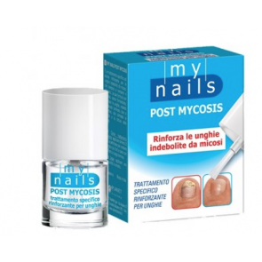 My Nails Post Mycosis 5 ml